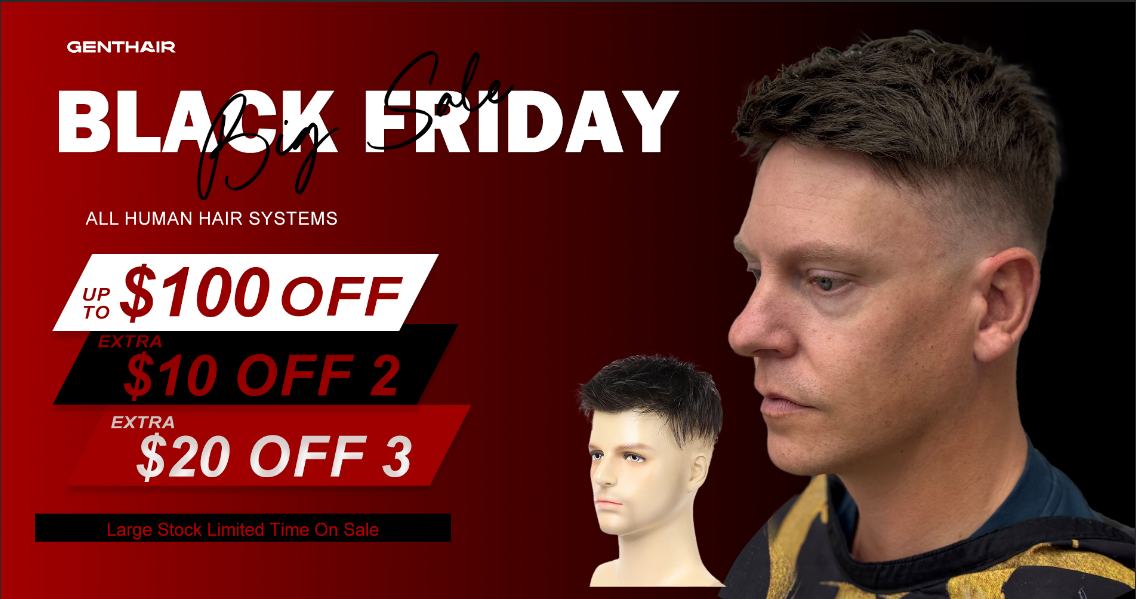 Black Friday Hair Upgrade Sale｜Confidence Starts at the Hairline
